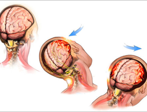 Concussion Safety